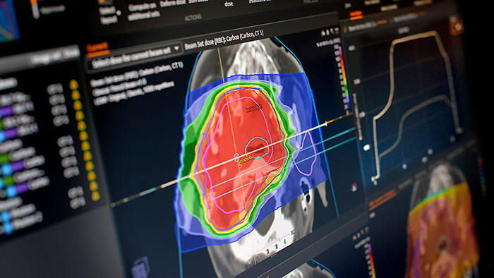 Pareto höjer medicinteknikbolag till köp - raysearch-affarsvarlden-700_binary_6867255.png