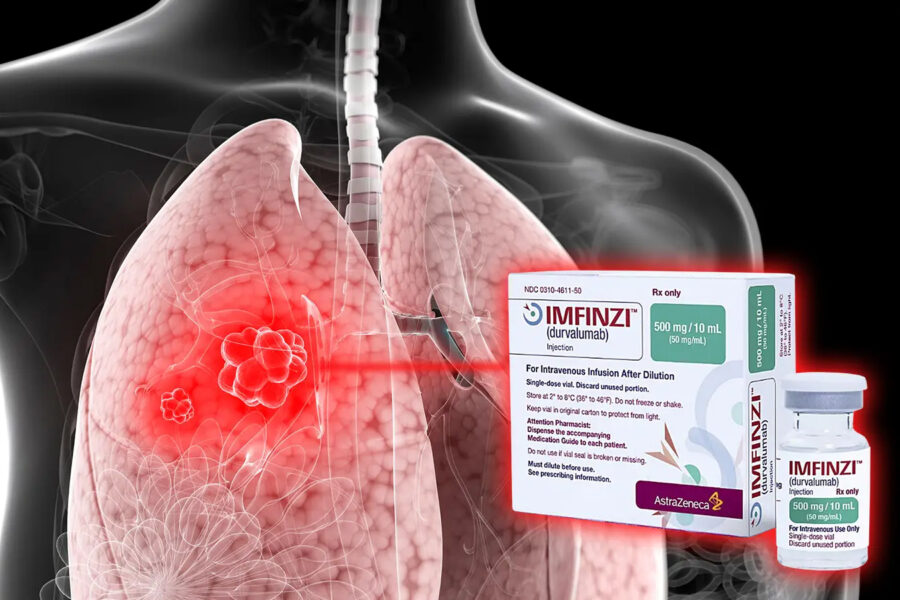 Positiva resultat för Astras läkemedel mot lungcancer - Astra Zeneca