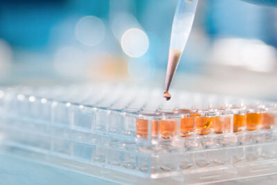 Hansa Biopharma
