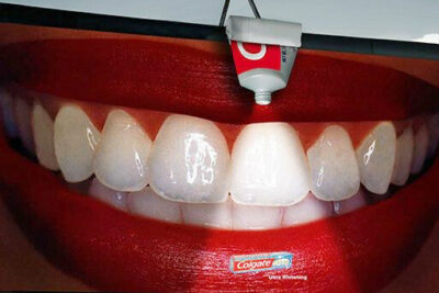 Colgate