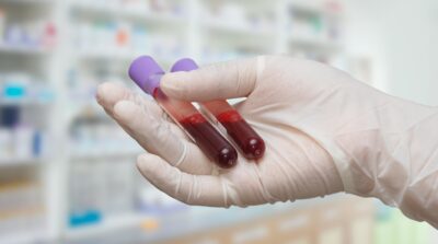 Två provrör med blod från Boule diagnostics