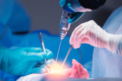 Doctor,Uses,Drill,To,Install,Pin,Screw,To,Properly,Fuse