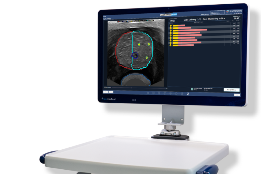 SpectraCures nyemission: Begränsat intresse trots stor rabatt - SpectraCure